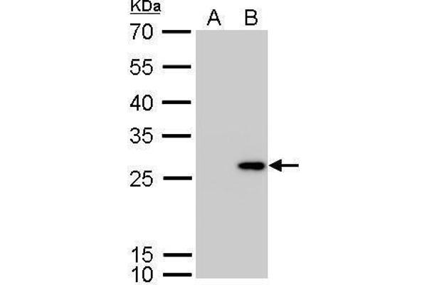Calretinin anticorps  (Center)