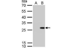 anti-Calbindin 2 (CALB2) (Center) antibody