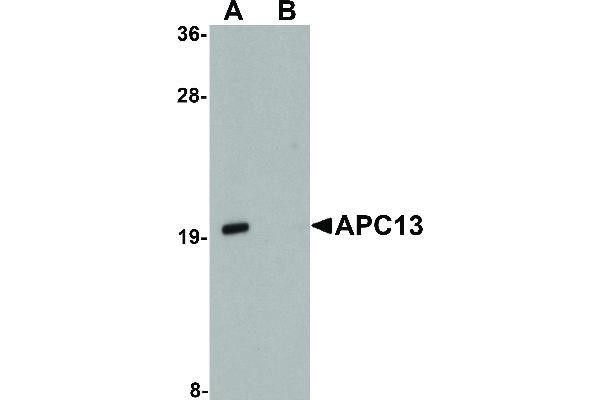 ANAPC13 抗体  (Internal Region)