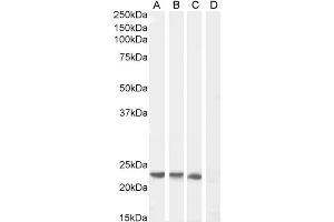 Image no. 2 for anti-Suppressor of Cytokine Signaling 1 (SOCS1) (C-Term) antibody (ABIN184575)