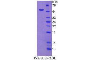 Image no. 1 for Tyrosine Hydroxylase (TH) (AA 45-214) protein (His tag,GST tag) (ABIN6238511)