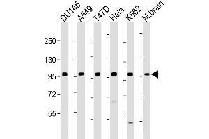 Image no. 8 for anti-Fibroblast Growth Factor Receptor 2 (FGFR2) (AA 22-51), (N-Term) antibody (ABIN391965)