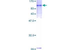 Image no. 1 for Interleukin 21 Receptor (IL21R) (AA 1-538) protein (GST tag) (ABIN2752827)