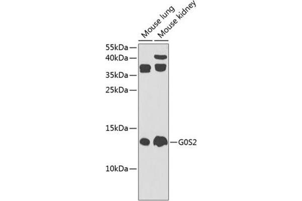 G0S2 antibody  (AA 1-100)