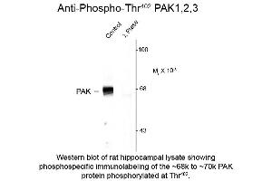 Image no. 1 for anti-P21-Activated Kinases 1/2/3 (PAK1/2/3) (pThr402) antibody (ABIN6658268)