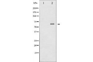 Image no. 14 for anti-Spleen tyrosine Kinase (SYK) (pTyr348) antibody (ABIN6255895)