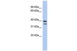Image no. 1 for anti-Methyltransferase Like 19 (METTL19) (AA 427-476) antibody (ABIN6743698)