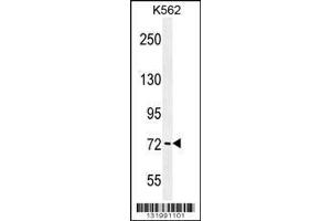 Image no. 1 for anti-P21-Activated Kinase 6 (PAK6) (AA 268-297) antibody (ABIN656098)
