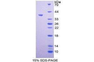 Image no. 1 for Arachidonate 12-Lipoxygenase (ALOX12) (AA 352-656) protein (His tag,T7 tag) (ABIN1981034)