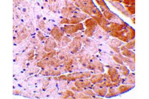 Image no. 3 for anti-Cell Death-Inducing DFFA-Like Effector A (CIDEA) (C-Term) antibody (ABIN6657449)