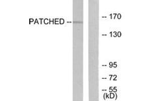 Image no. 1 for anti-Patched 1 (PTCH1) (AA 1-50) antibody (ABIN1533374)