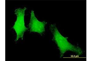 Immunofluorescence of purified MaxPab antibody to PTTG1 on HeLa cell.