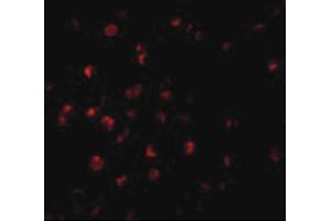 Image no. 2 for anti-Baculoviral IAP Repeat-Containing 8 (BIRC8) (N-Term) antibody (ABIN6656732)