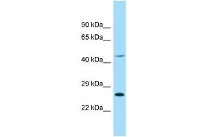 Image no. 1 for anti-Eukaryotic Translation Initiation Factor 4E Family Member 1B (EIF4E1B) (Middle Region) antibody (ABIN2790539)