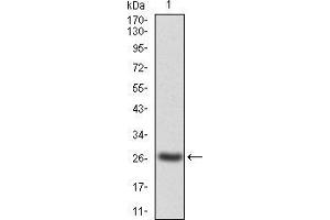 Image no. 2 for anti-Janus Kinase 2 (JAK2) (AA 745-955) antibody (ABIN5542629)
