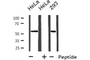 Image no. 3 for anti-Cytochrome P450, Family 39, Subfamily A, Polypeptide 1 (CYP39A1) (C-Term) antibody (ABIN6258391)