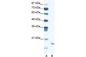 Image no. 1 for anti-Second Mitochondria-Derived Activator of Caspase (DIABLO) (C-Term) antibody (ABIN2792127)