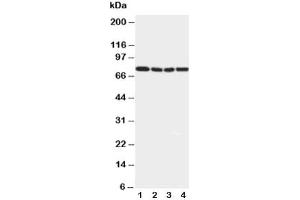 Western blot testing of IRAK1 antibody and Lane 1:  rat liver