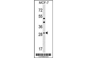 Image no. 1 for anti-Dehydrogenase/reductase (SDR Family) Member 11 (DHRS11) (AA 115-142) antibody (ABIN1537768)