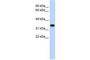 Image no. 1 for anti-Actin-Related Protein T1 (ACTRT1) (AA 287-336) antibody (ABIN6741144)