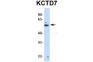 Image no. 3 for anti-Potassium Channel Tetramerisation Domain Containing 7 (KCTD7) (N-Term) antibody (ABIN2776287)