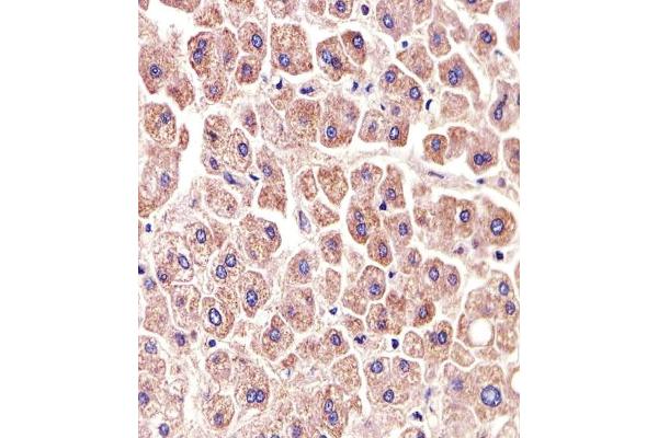 ALDH6A1 antibody