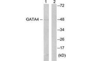 Image no. 1 for anti-GATA Binding Protein 4 (GATA4) (AA 71-120) antibody (ABIN1532617)