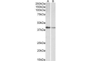 Image no. 2 for anti-Cardiac Troponin T (cTnT) (AA 201-213) antibody (ABIN2613399)