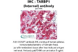 Image no. 2 for anti-TAR (HIV-1) RNA Binding Protein 1 (TARBP1) (Internal Region) antibody (ABIN1739905)