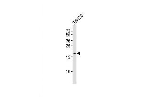 Image no. 1 for anti-Deoxyuridine Triphosphatase (DUT) (AA 170-198), (C-Term) antibody (ABIN5534888)