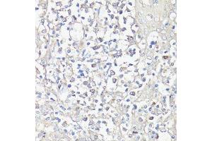 Image no. 7 for anti-Nuclear Factor of Activated T-Cells, Cytoplasmic, Calcineurin-Dependent 1 (NFATC1) antibody (ABIN3022101)