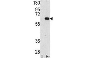 Image no. 3 for anti-Autocrine Motility Factor Receptor (AMFR) (AA 571-601) antibody (ABIN3030083)