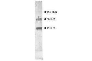 Western blot analysis with Alcohol Dehydrogenase antibody used to detect yeast Alcohol Dehydrogenase.