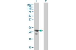 Image no. 2 for anti-COP9 Signalosome Subunit 8 (COPS8) (AA 1-209) antibody (ABIN524324)