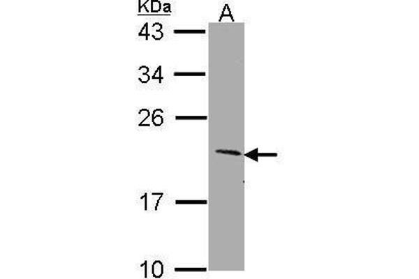anti-SERTA Domain Containing 1 (SERTAD1) (N-Term) antibody
