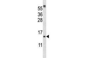 Image no. 4 for anti-Small Ubiquitin Related Modifier Protein 1 (SUMO1) (AA 1-30) antibody (ABIN3032639)