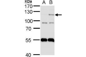 Image no. 1 for anti-Endothelial PAS Domain Protein 1 (EPAS1) (Center) antibody (ABIN2855683)