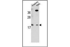 Image no. 3 for anti-Ring Finger Protein 185 (RNF185) (AA 91-121), (Middle Region) antibody (ABIN954570)