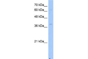 Image no. 1 for anti-NAD(P) Dependent Steroid Dehydrogenase-Like (NSDHL) (Middle Region) antibody (ABIN2773893)