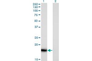 Image no. 2 for anti-HRAS-Like Suppressor 3 (PLA2G16) (AA 1-162) antibody (ABIN524568)