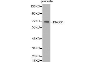 Western Blotting (WB) image for anti-Protein S (PROS) (AA 405-676) antibody (ABIN1513429)