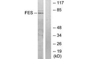 Image no. 1 for anti-Feline Sarcoma Oncogene (FES) (AA 131-180) antibody (ABIN1533592)