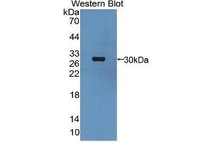 Image no. 1 for anti-Ureidopropionase, beta (UPB1) (AA 154-393) antibody (ABIN5014504)