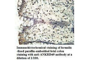 Image no. 1 for anti-Ankyrin Repeat Domain 49 (ANKRD49) antibody (ABIN6584233)
