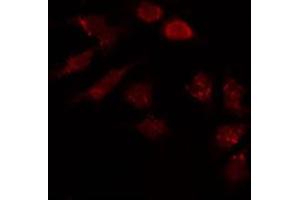 Image no. 2 for anti-Hyaluronan and Proteoglycan Link Protein 1 (HAPLN1) (N-Term) antibody (ABIN6262149)