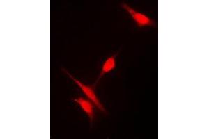 Image no. 1 for anti-Histone Deacetylase 10 (HDAC10) (N-Term) antibody (ABIN2707550)