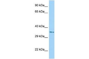 Image no. 1 for anti-Nucleotide Binding Protein-Like (NUBPL) (C-Term) antibody (ABIN2790827)