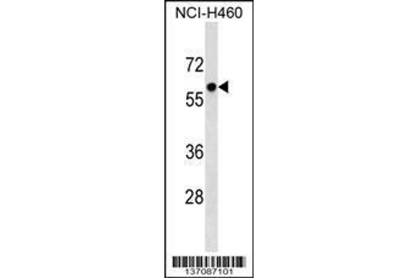 anti-Primase, DNA, Polypeptide 2 (58kDa) (PRIM2) (AA 317-345) antibody