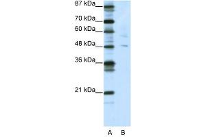 Image no. 1 for anti-Pleiomorphic Adenoma Gene-Like 1 (PLAGL1) (N-Term) antibody (ABIN925908)