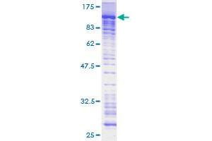 Image no. 1 for PML-RARA Regulated Adaptor Molecule 1 (PRAM1) (AA 1-670) protein (GST tag) (ABIN1316121)